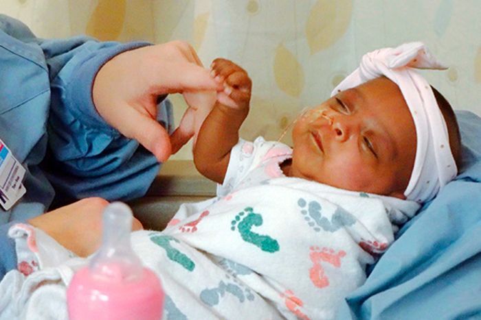 World’s tiniest surviving baby all healthy