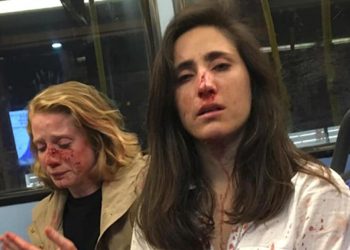 Two women attacked in UK for not kissing each other
