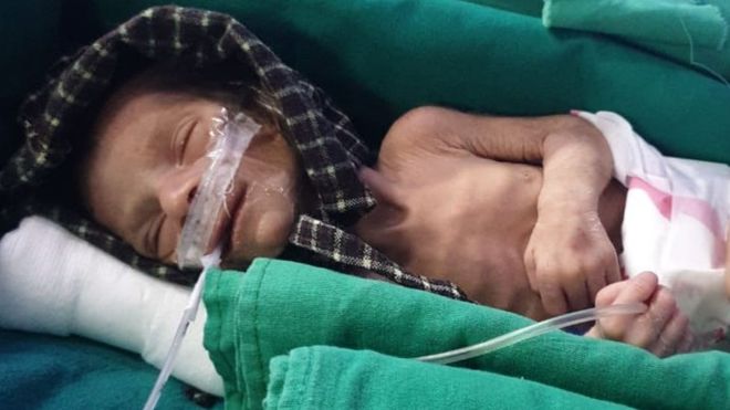 Newborn girl found alive in shallow grave in India