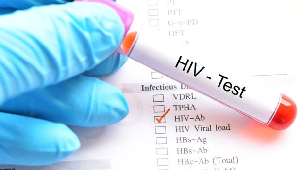 HIV infected on the rise