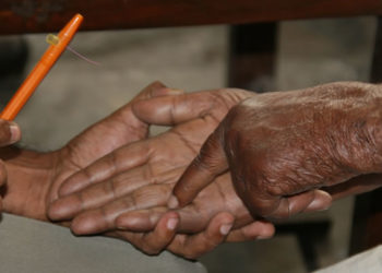 Banke, Bardiya face challenges for leprosy elimination