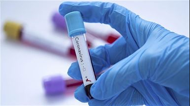 India’s journalist tests positive for coronavirus