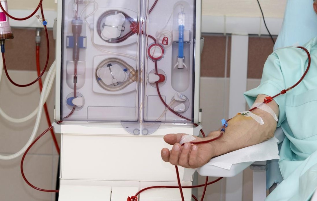 Free dialysis service in Beni hospital