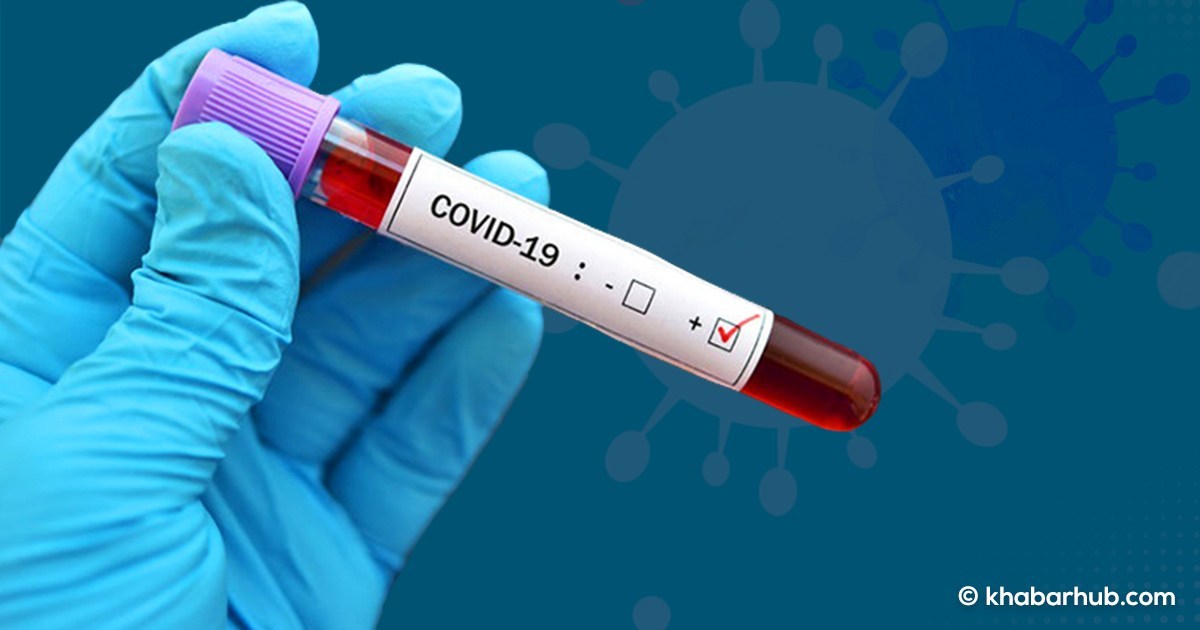 Coronavirus infection confirmed in more than 50 percent samples tested