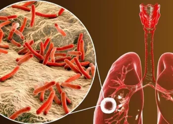 World Tuberculosis Day: 17,000 Nepali nationals lose their lives annually